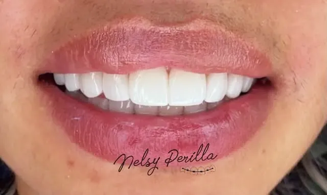 Sonrisa al terminar el tratamiento